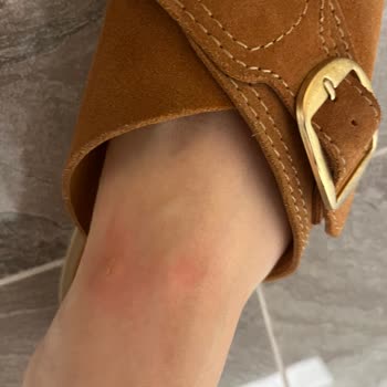 Greyder Terlikleri Ayak Sağlığımı Tehdit Ediyor!