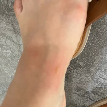 Greyder Terlikleri Ayak Sağlığımı Tehdit Ediyor!