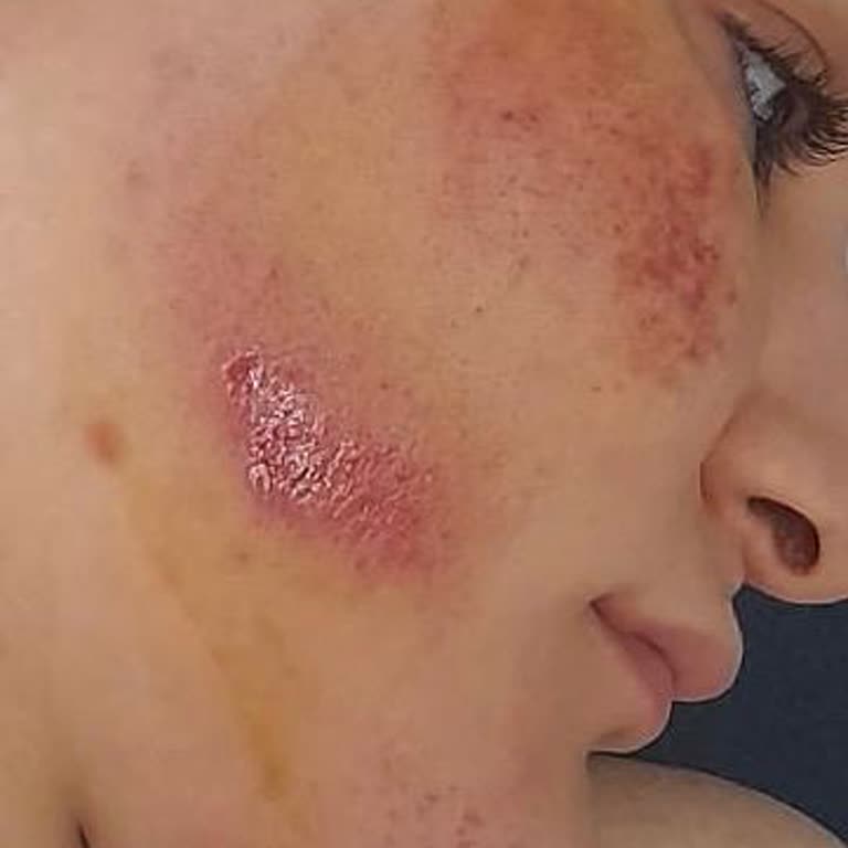 Medical Park Hastanesi Sekreter Hatası Hayati Tehlike Yarattı