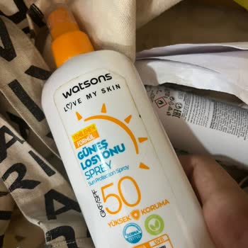 Watsons Alerjik Reaksiyon Yaptı