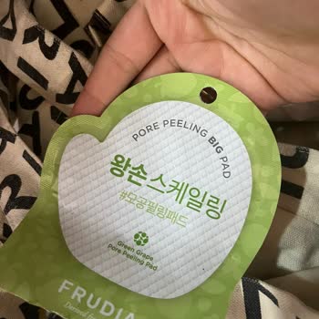 Watsons Alerjik Reaksiyon Yaptı