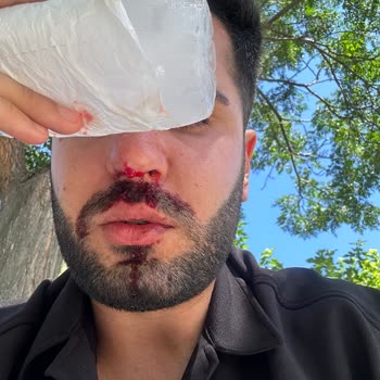 Türkiye Sigorta Kazadan Sonra Yaşanan Zorluklar