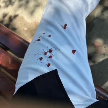 Türkiye Sigorta Kazadan Sonra Yaşanan Zorluklar