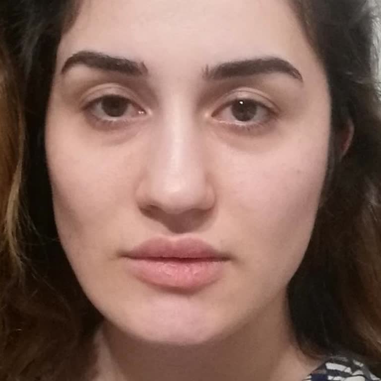 Prof. Dr. Kemal Uğurlu Çene Ameliyatı Sonrası Yaşanan Sorunlar