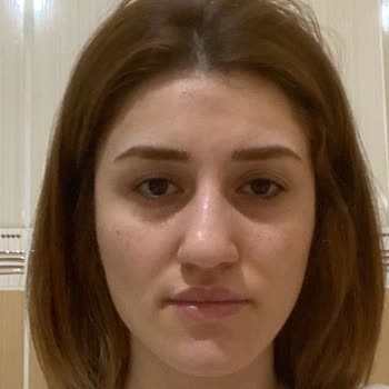 Prof. Dr. Kemal Uğurlu Çene Ameliyatı Sonrası Yaşanan Sorunlar