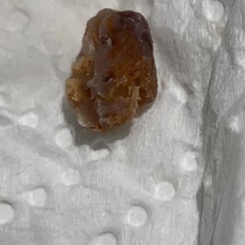 Komagene Çiğ Köftede Şaşırtıcı Ve Rahatsız Edici Deneyim