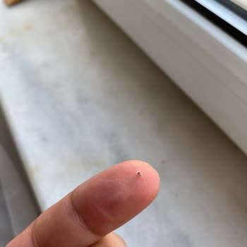 Sleepy Bezden Yabancı Cisim Çıktı