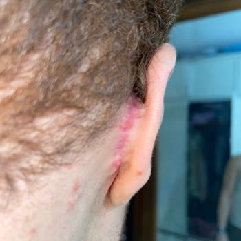 Op. Dr Sevin Özgül Op. Dr. Sevin Özgül Kulağımda Bitmeyen Ameliyat Kabusu: 3 Kez Masaya Yattım!