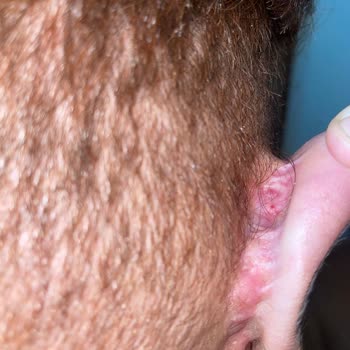 Op. Dr Sevin Özgül Op. Dr. Sevin Özgül Kulağımda Bitmeyen Ameliyat Kabusu: 3 Kez Masaya Yattım!