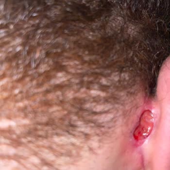 Op. Dr Sevin Özgül Op. Dr. Sevin Özgül Kulağımda Bitmeyen Ameliyat Kabusu: 3 Kez Masaya Yattım!