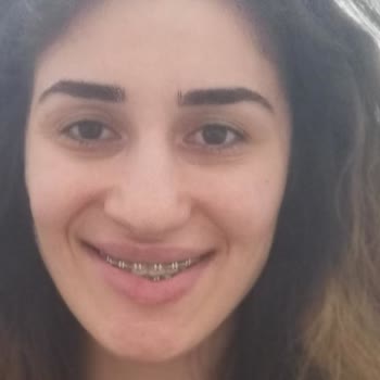 Eki aç