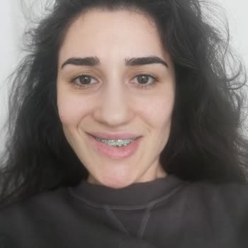 Eki aç