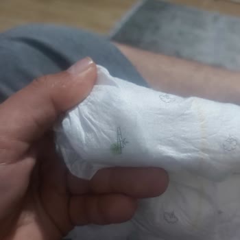 Sleepy Bezin İçerisinde Topaklanmış Maddeler Var