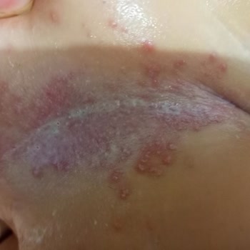 Bebem Natural Bebek Bezi Şikayet