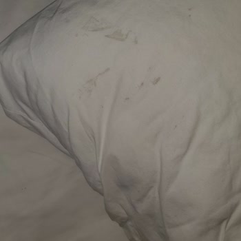 Club Hotel Mirabell Oda Temizliği Ve Hizmet Eksikliği