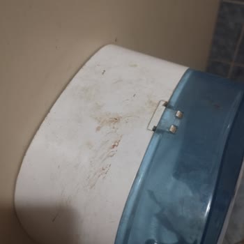 Gaziantep Üniversitesi Şahinbey Araştırma ve Uygulama Hastanesi Üniversite Hastanesinin Tuvaleti Hiç Temizlenmiyor