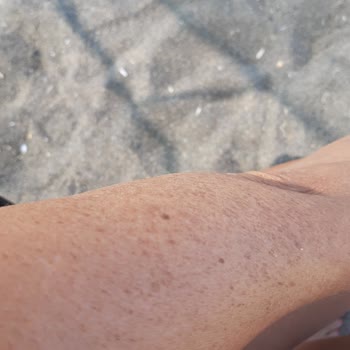 Rossmann Yakan Güneş Spreyi