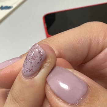 Gratis Beauty Hijyen Eksikliği Ve Sağlık Sorunları Yaşadım!
