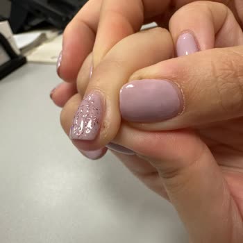 Gratis Beauty Hijyen Eksikliği Ve Sağlık Sorunları Yaşadım!