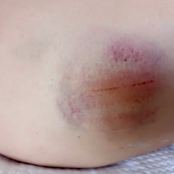 Azure By Yelken Hotel Şikayetçiyim