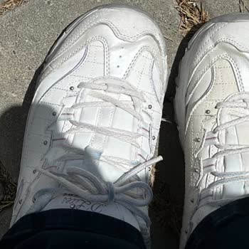 Skechers Pişmanlıktır! Sattığı Ürünün Arkasında Durmuyor.