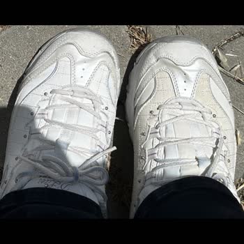 Skechers Pişmanlıktır! Sattığı Ürünün Arkasında Durmuyor.