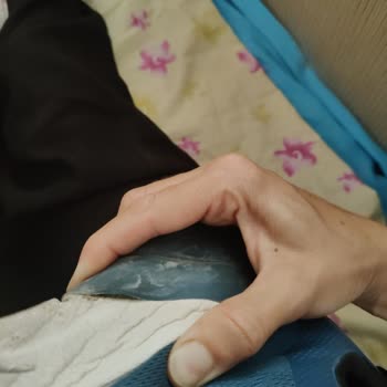 Skechers Yaptığı Hatayı Kabul Etmedi...