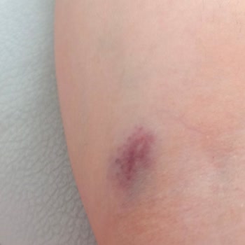 Meddem Hastanesi Kan Alma Bölümü