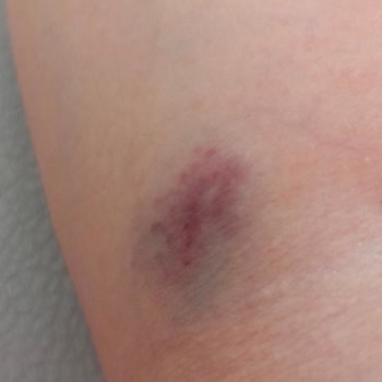 Meddem Hastanesi Kan Alma Bölümü