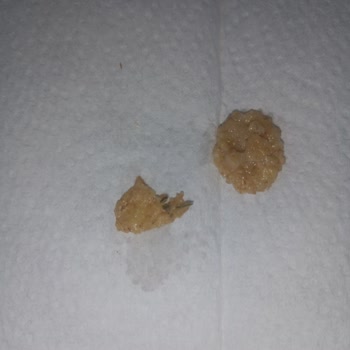 Kellogg's Mısır Gevreğinden Yabancı Madde Çıktı