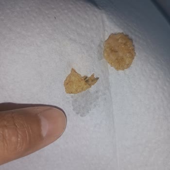 Kellogg's Mısır Gevreğinden Yabancı Madde Çıktı