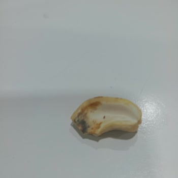 A101 Çerezya Bozuk Ürün Fıstık Küflü