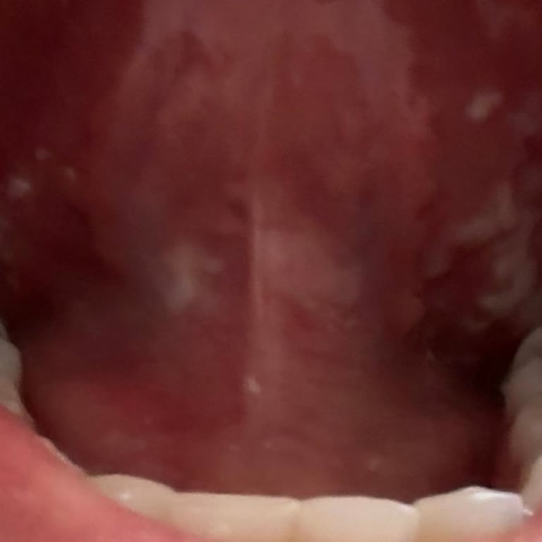 Sensodyne Hassas Diş Macunu