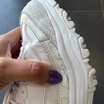 Skechers Marka Ayakkabının Kalitesizliği