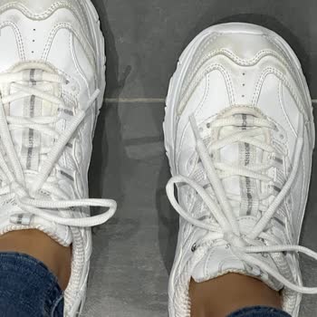 Skechers Marka Ayakkabının Kalitesizliği