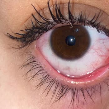 Loreal Paradise Maskara Kör Ediyordu