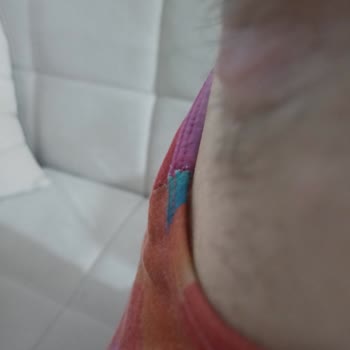 Rexona Hiç Memnun Kalmadım Koltuk Altım Şişti