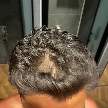 Ekrem Civaş Klinik Kök Hücre Tedavisi Kocaman Bir Yalandır.