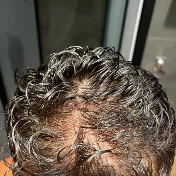 Ekrem Civaş Klinik Kök Hücre Tedavisi Kocaman Bir Yalandır.