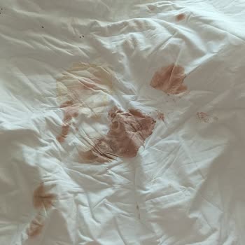 Ankara Etlik Şehir Hastanesi Temizlik Görevlisinin Görevini Yapmaması