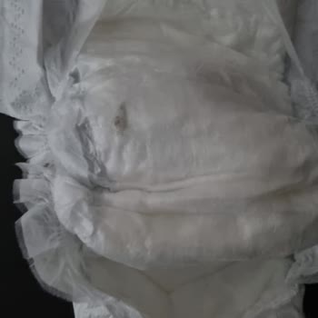 Sleepy Bebek Bezinin İçinde Çıkan Yabancı Madde