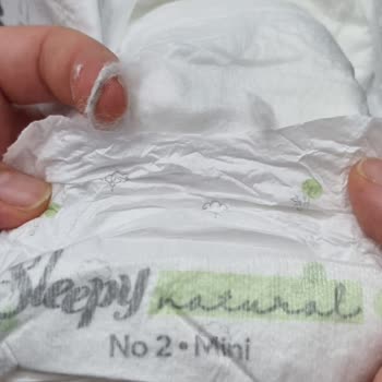 Sleepy Bebek Bezinin İçinde Çıkan Yabancı Madde