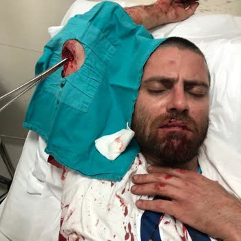 Emre Bilgisayar Gece Yarısı Saldırısı Ve Yetersiz Müdahale