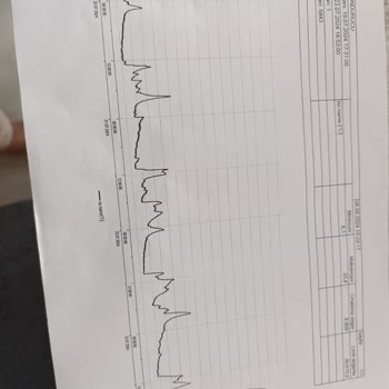 Profilo Marka Buzdolabım Soğutmuyor