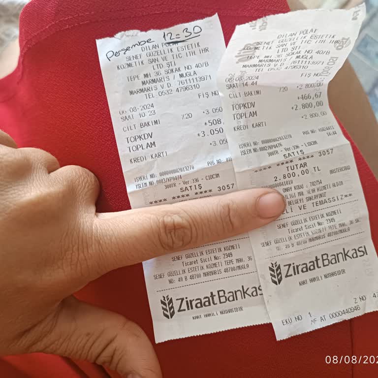 Dilan Polat Estetik Yapılan İşlemden Memnun Kalmadım