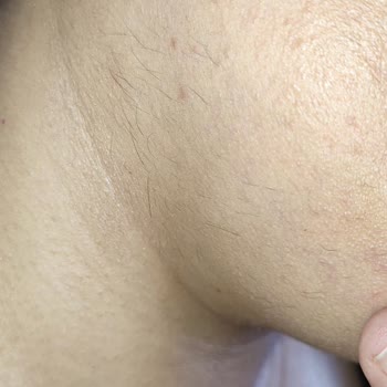 Pınar Kuaför ve Güzellik Salonu Epilasyon Hizmetinde Beklenmeyen Sonuçlar Ve Kötü Davranışlar