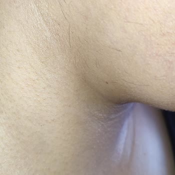 Pınar Kuaför ve Güzellik Salonu Epilasyon Hizmetinde Beklenmeyen Sonuçlar Ve Kötü Davranışlar