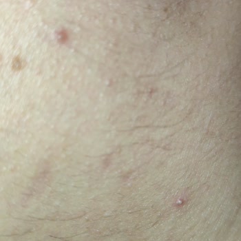 Pınar Kuaför ve Güzellik Salonu Epilasyon Hizmetinde Beklenmeyen Sonuçlar Ve Kötü Davranışlar