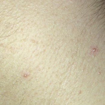 Pınar Kuaför ve Güzellik Salonu Epilasyon Hizmetinde Beklenmeyen Sonuçlar Ve Kötü Davranışlar