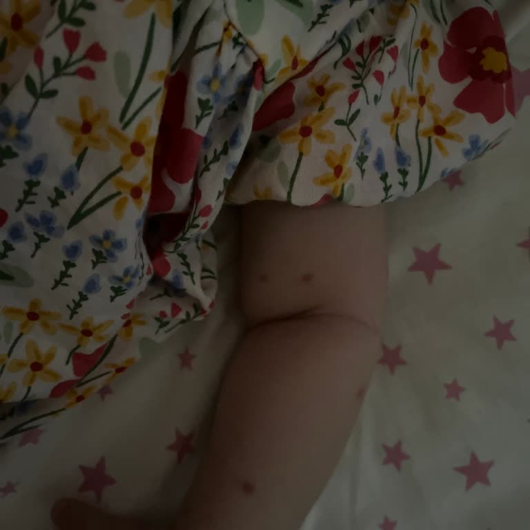 Bebelac Gold Mama Kullanımı Sonrası Yaşanan Alerji Ve Sindirim Sorunları